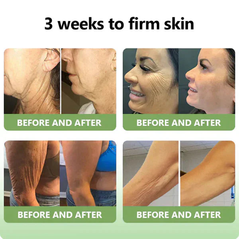 💖LOVILDS™ Luxury Firming Collagen Cream 🎄( 🔥50% off for a limited time!)