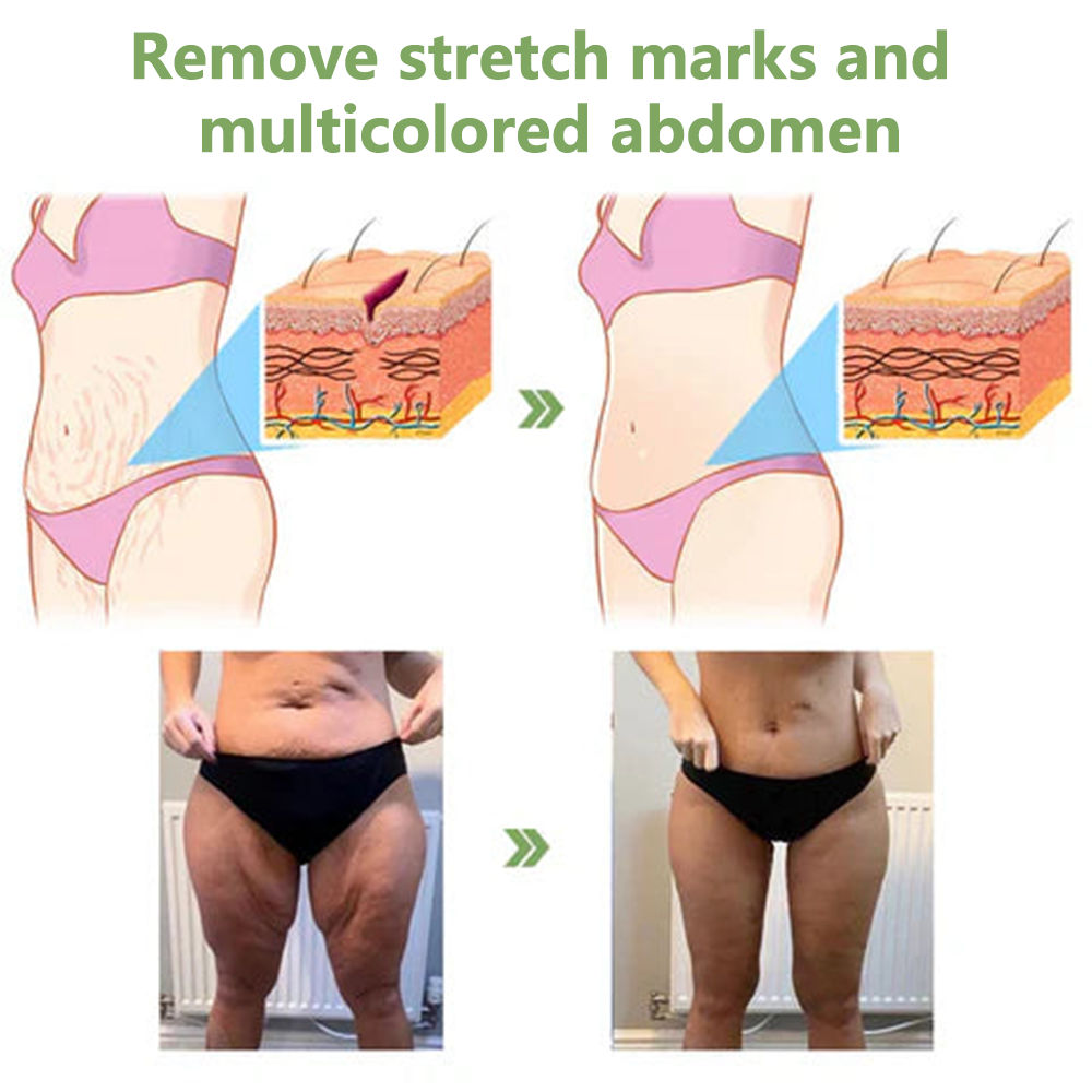 💖LOVILDS™ Luxury Firming Collagen Cream 🎄( 🔥50% off for a limited time!)