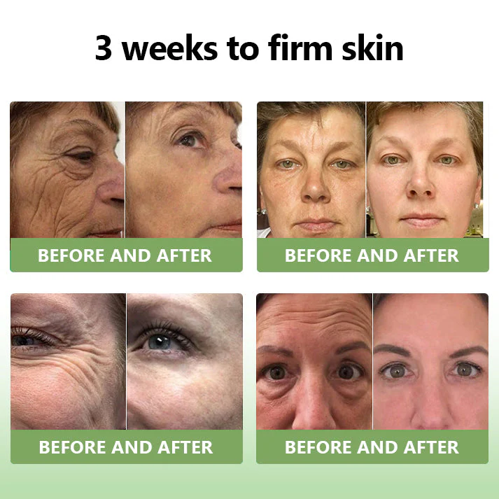 💖LOVILDS™ Luxury Firming Collagen Cream 🎄( 🔥50% off for a limited time!)