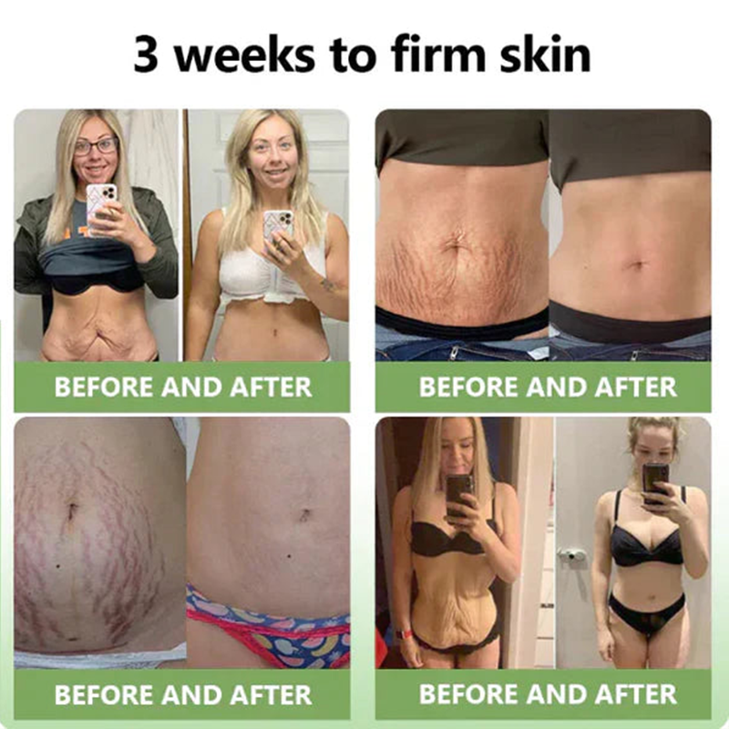 💖LOVILDS™ Luxury Firming Collagen Cream 🎄( 🔥50% off for a limited time!)