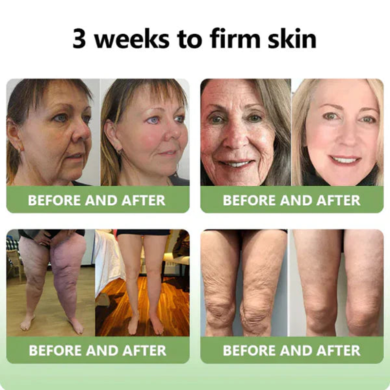 💖LOVILDS™ Luxury Firming Collagen Cream 🎄( 🔥50% off for a limited time!)